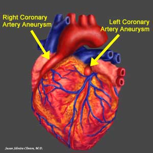 �������� KAWASAKI (12).jpg